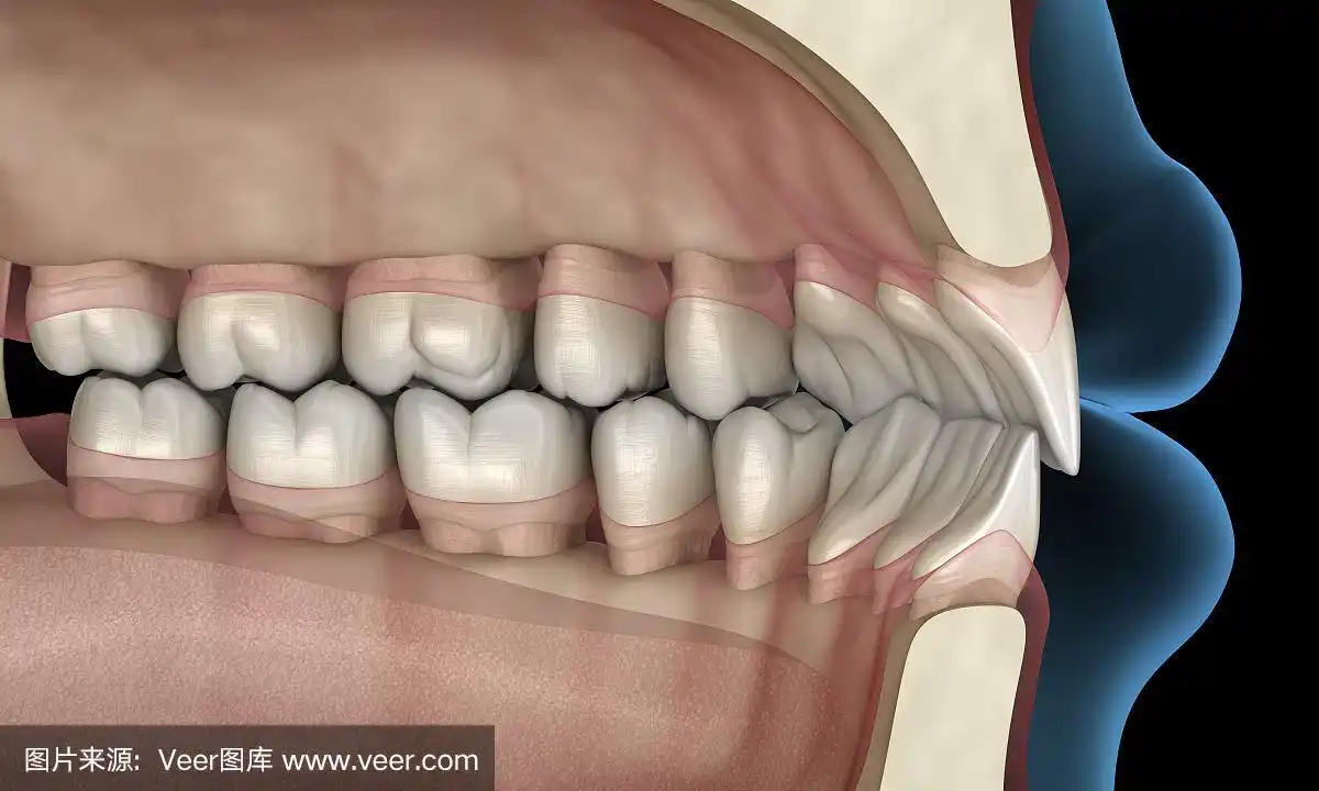 健康的人类牙齿与正常咬合,3d插图